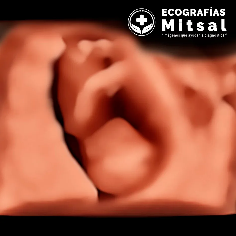 Ecografía obstétrica temprana