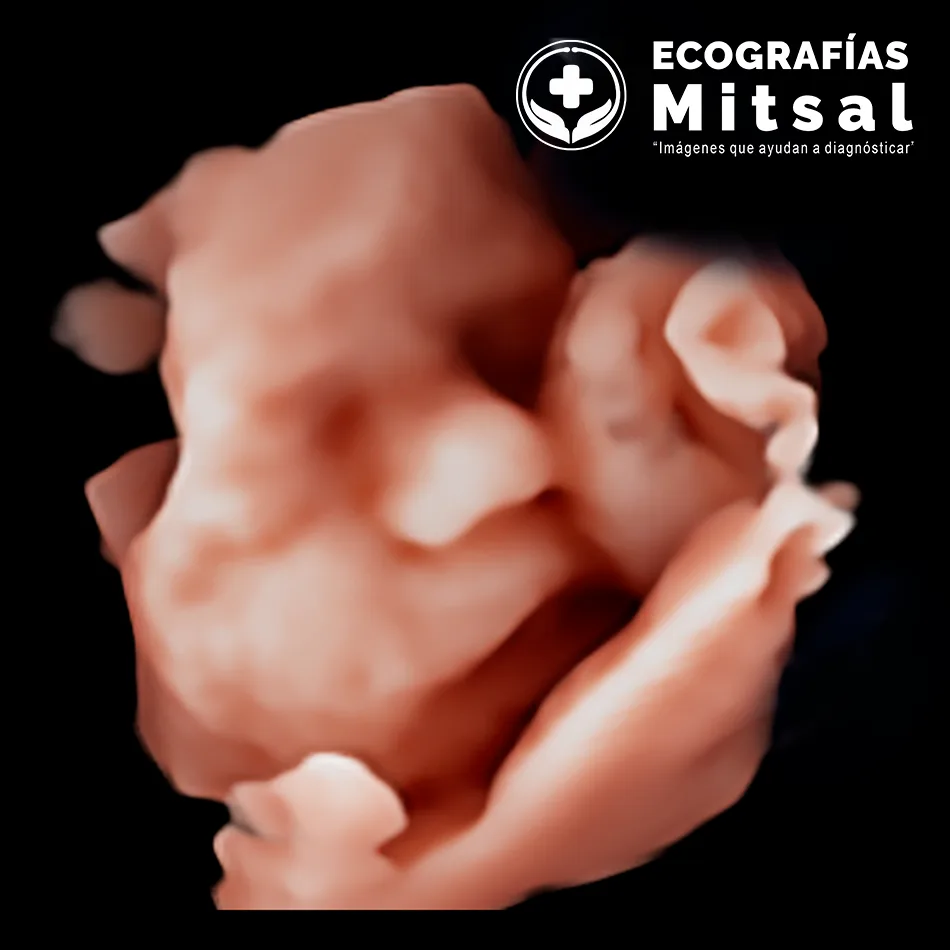 Ecografía morfológica (2T)